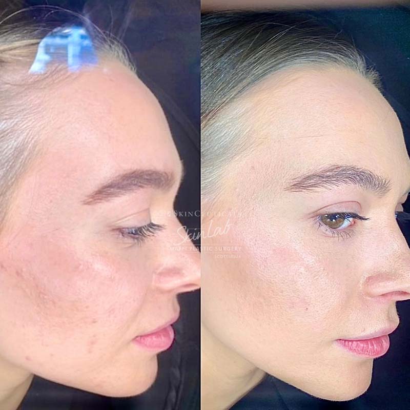 Before & After Photos | Scottsdale, AZ | SkinLab by Maffi Plastic Surgery